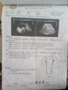 贵阳结石病医院帮助9岁结石男孩“逃过一劫”